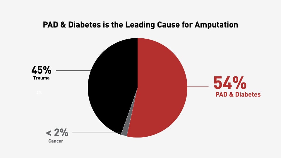 Causes for Amputation Pie Chart.001